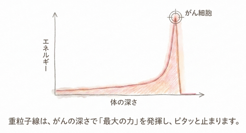 ブラッグ・ピークのイメージ図